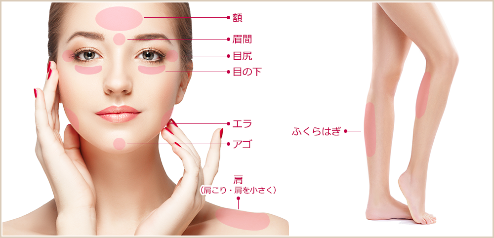 ボツリヌス注射 注入部位